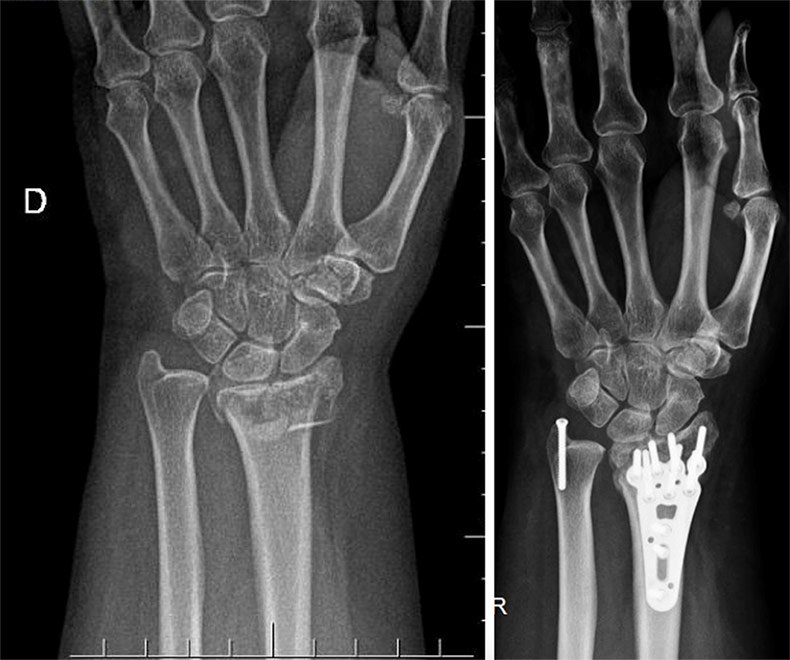 Dr. Thiago Albeny Ortopedia e traumatologia especializada em mãos Dr. Thiago Albeny Ortopedia e traumatologia especializada em mãos